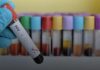 Aids: 1º semestre de 2023 tem menor número de casos da história do DF.