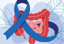 Março Azul-Marinho: veja atividades físicas que ajudam no combate ao câncer colorretal